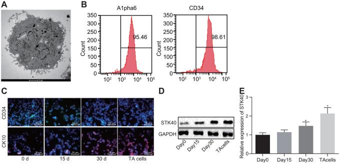 https://cdn.ncbi.nlm.nih.gov/pmc/blobs/f6f5/7377840/6179b41ddb8e/aging-12-103165-g001.jpg