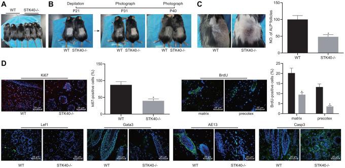 https://cdn.ncbi.nlm.nih.gov/pmc/blobs/f6f5/7377840/fa0daf4b5ed3/aging-12-103165-g003.jpg
