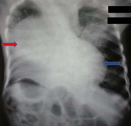 https://cdn.ncbi.nlm.nih.gov/pmc/blobs/f6f9/6607463/b7361b153ec0/PAMJ-32-167-g001.jpg