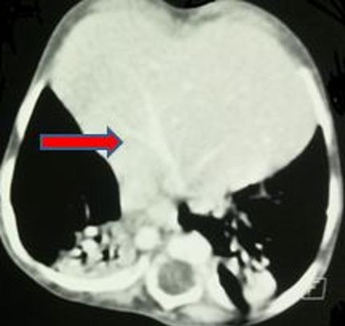 https://cdn.ncbi.nlm.nih.gov/pmc/blobs/f6f9/6607463/d34469bab8b0/PAMJ-32-167-g004.jpg