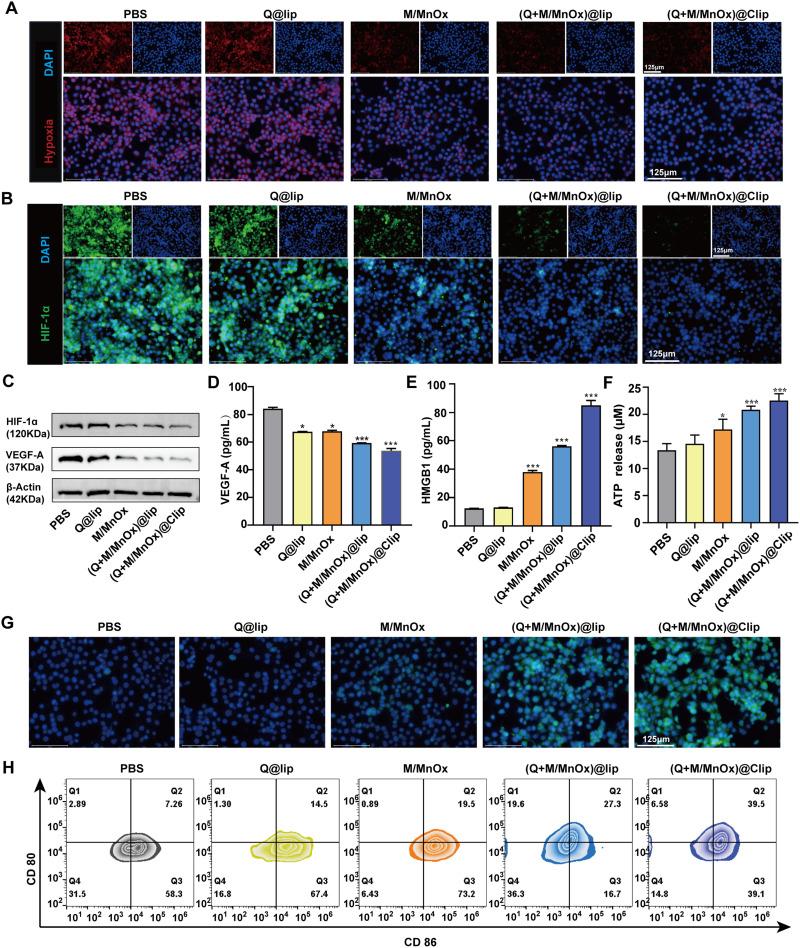 https://cdn.ncbi.nlm.nih.gov/pmc/blobs/f6fb/12136069/38dfcfd19c10/IJN-20-7113-g0005.jpg