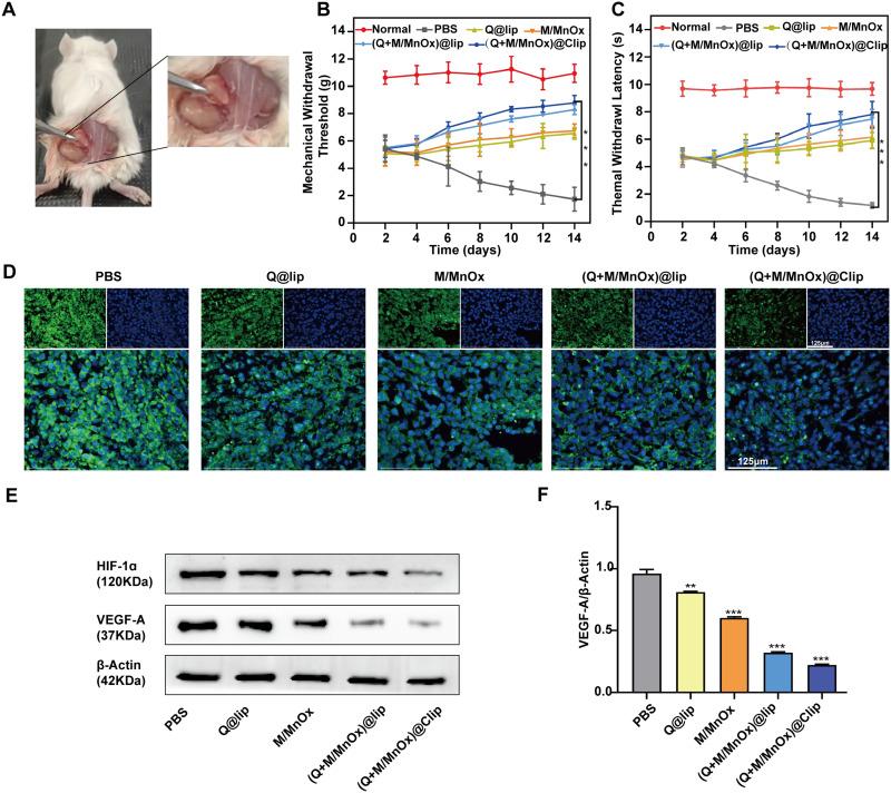 https://cdn.ncbi.nlm.nih.gov/pmc/blobs/f6fb/12136069/5b364372f36b/IJN-20-7113-g0009.jpg