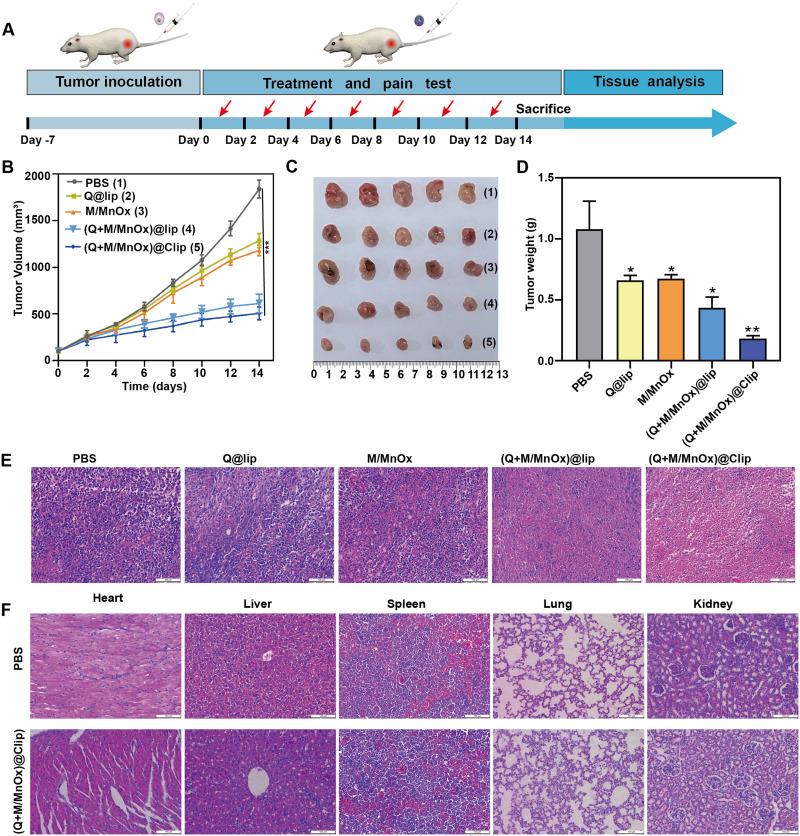 https://cdn.ncbi.nlm.nih.gov/pmc/blobs/f6fb/12136069/911cf7426754/IJN-20-7113-g0007.jpg