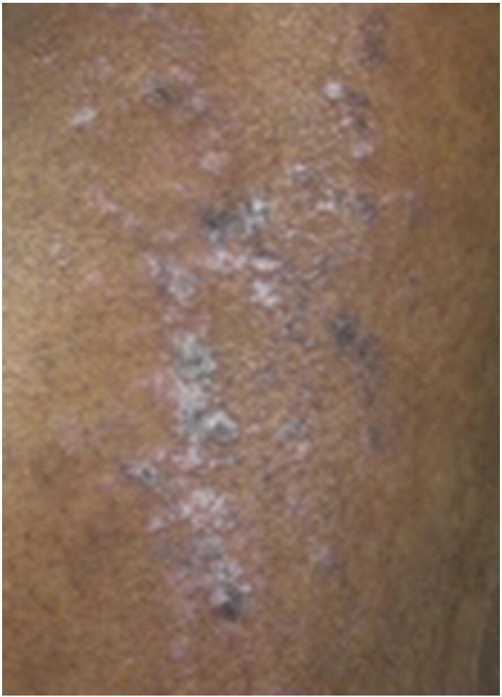 https://cdn.ncbi.nlm.nih.gov/pmc/blobs/f6fd/5418875/3df5b19cf318/gr1.jpg