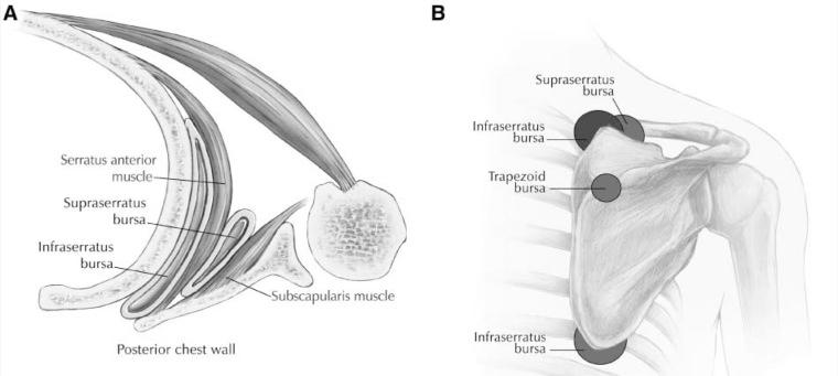 https://cdn.ncbi.nlm.nih.gov/pmc/blobs/f702/3445084/4f8c6d646862/10.1177_1941738109338359-fig1.jpg