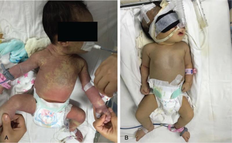 https://cdn.ncbi.nlm.nih.gov/pmc/blobs/f70c/5690761/43938aa3058e/medi-96-e8549-g003.jpg
