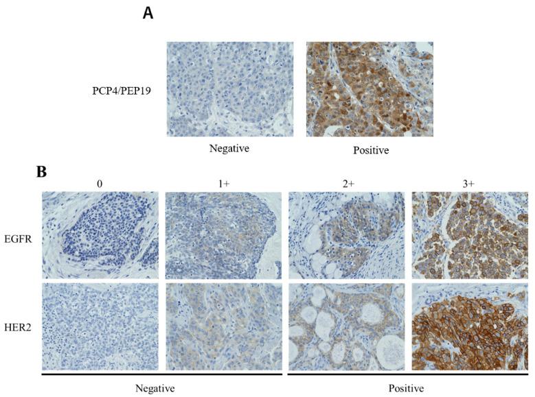 https://cdn.ncbi.nlm.nih.gov/pmc/blobs/f70e/8750196/0fc0eecc3e67/cancers-14-00054-g001.jpg