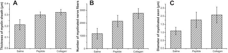 https://cdn.ncbi.nlm.nih.gov/pmc/blobs/f715/3758218/23d0b4b14cdf/ijn-8-3217Fig11.jpg