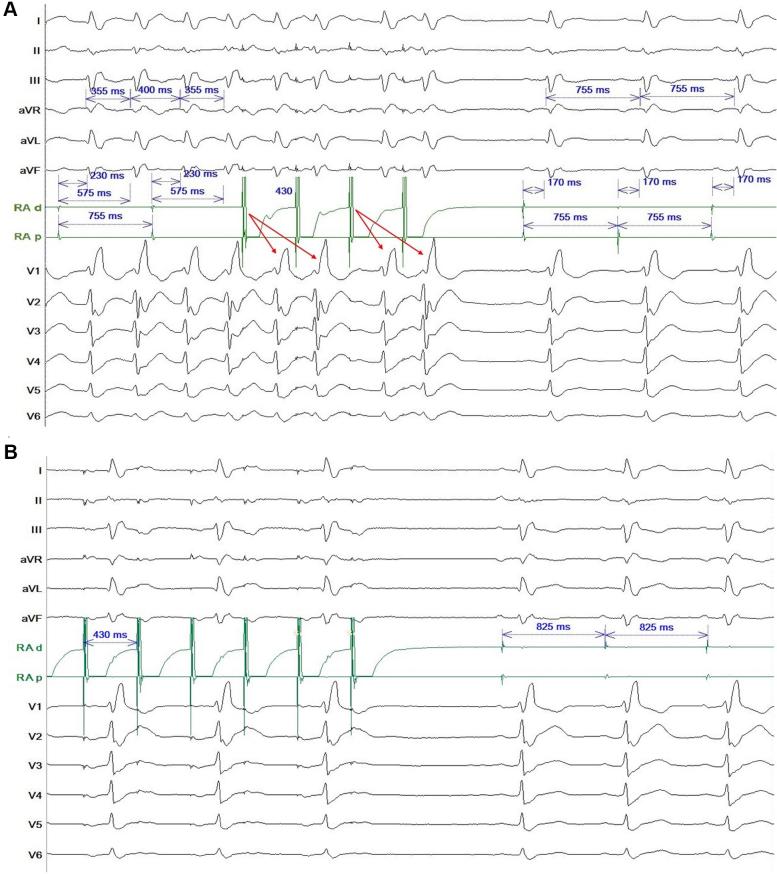 https://cdn.ncbi.nlm.nih.gov/pmc/blobs/f716/7498521/39b4972c5e05/gr3.jpg
