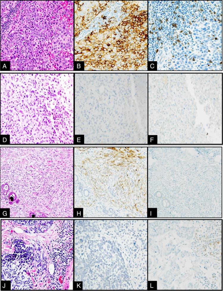 https://cdn.ncbi.nlm.nih.gov/pmc/blobs/f719/5339564/605088f09a7e/jclinpath-2016-203874f01.jpg
