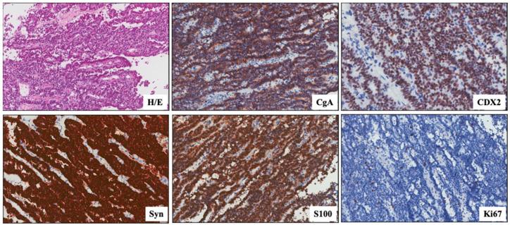 https://cdn.ncbi.nlm.nih.gov/pmc/blobs/f71f/10886459/27d0024b481b/biomedicines-12-00379-g004.jpg
