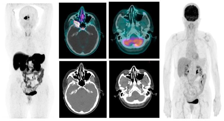 https://cdn.ncbi.nlm.nih.gov/pmc/blobs/f71f/10886459/48b038eacaf4/biomedicines-12-00379-g005.jpg