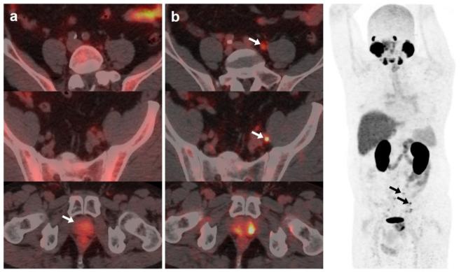 https://cdn.ncbi.nlm.nih.gov/pmc/blobs/f721/10378109/5c26ef018853/curroncol-30-00464-g001.jpg