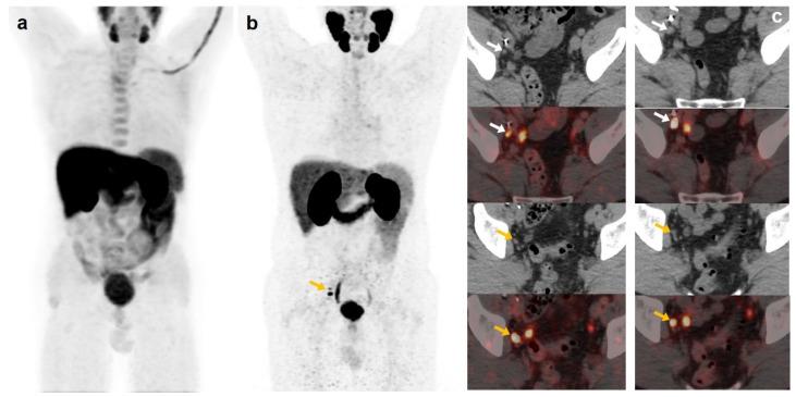 https://cdn.ncbi.nlm.nih.gov/pmc/blobs/f721/10378109/7d26b929997a/curroncol-30-00464-g003.jpg