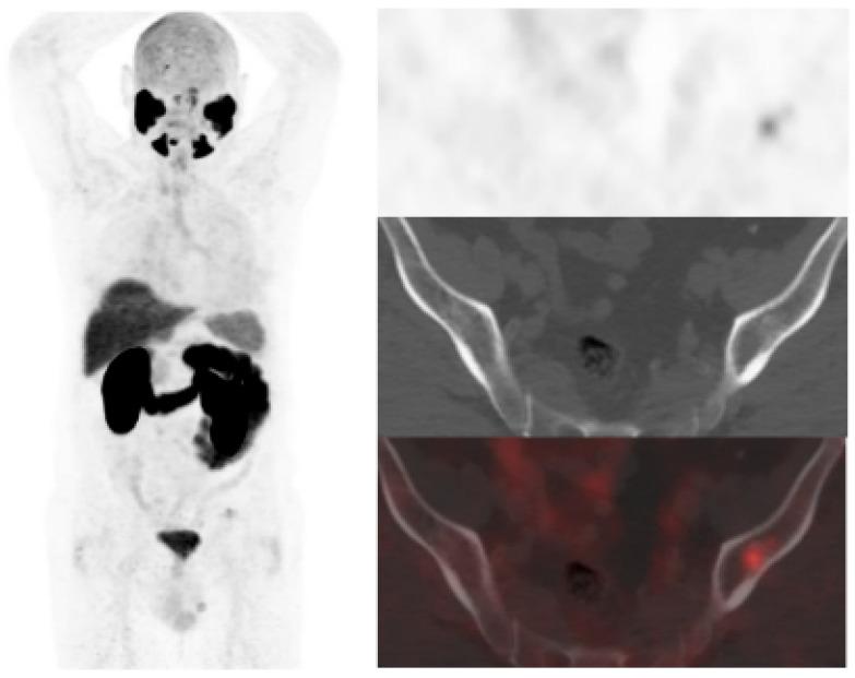 https://cdn.ncbi.nlm.nih.gov/pmc/blobs/f721/10378109/9fc71c8b4671/curroncol-30-00464-g005.jpg
