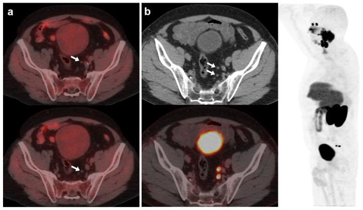 https://cdn.ncbi.nlm.nih.gov/pmc/blobs/f721/10378109/a388cdadec3d/curroncol-30-00464-g002.jpg