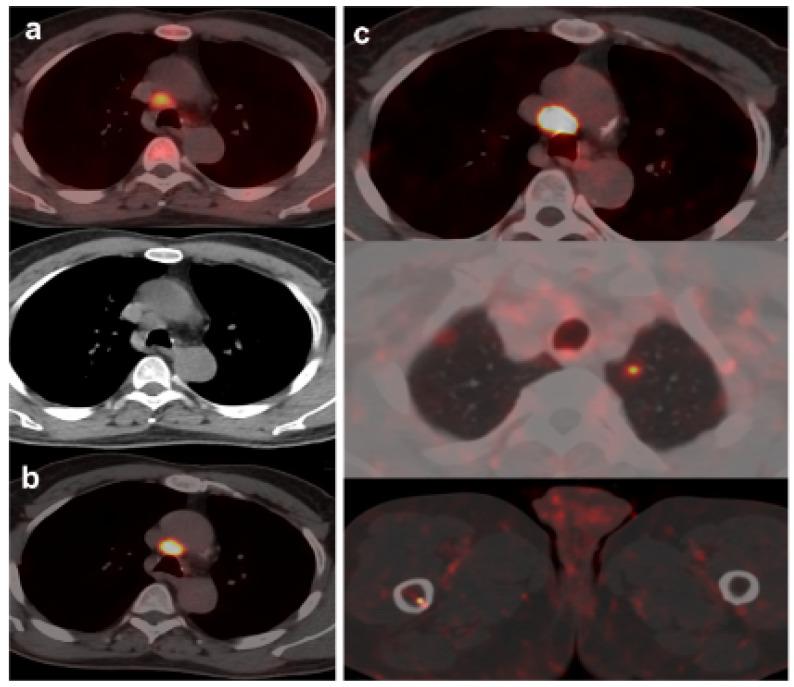 https://cdn.ncbi.nlm.nih.gov/pmc/blobs/f721/10378109/a4b6122bb222/curroncol-30-00464-g004.jpg