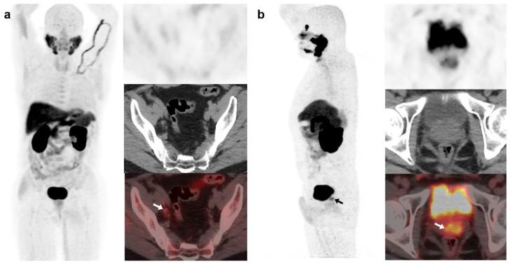 https://cdn.ncbi.nlm.nih.gov/pmc/blobs/f721/10378109/e27c4338c89c/curroncol-30-00464-g006.jpg