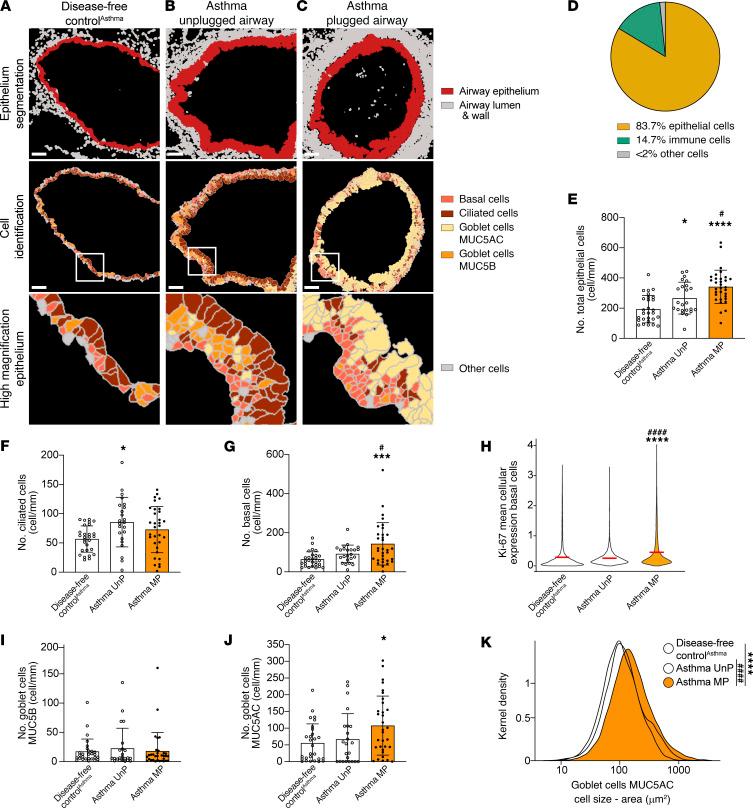 https://cdn.ncbi.nlm.nih.gov/pmc/blobs/f721/11910225/b4d9ef4f952f/jci-135-186889-g164.jpg