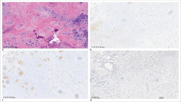 https://cdn.ncbi.nlm.nih.gov/pmc/blobs/f722/11474753/0c93a47b5386/Cytojournal-21-31-g005.jpg