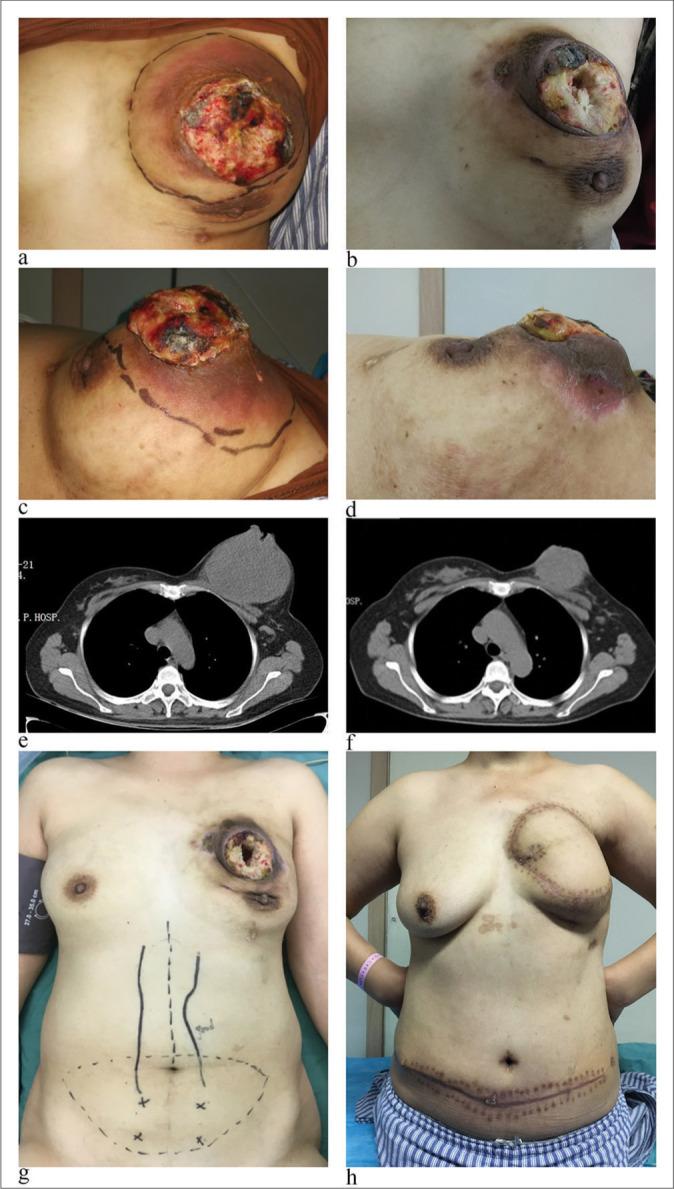 https://cdn.ncbi.nlm.nih.gov/pmc/blobs/f722/11474753/0cf7abcd7aea/Cytojournal-21-31-g004.jpg