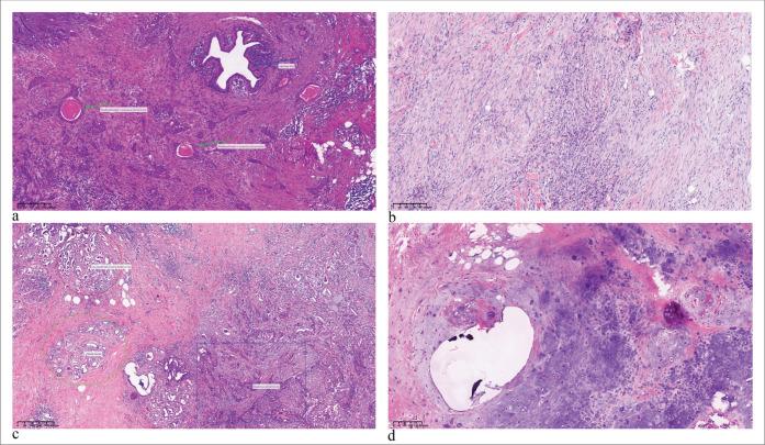https://cdn.ncbi.nlm.nih.gov/pmc/blobs/f722/11474753/7b36236ef6d8/Cytojournal-21-31-g001.jpg
