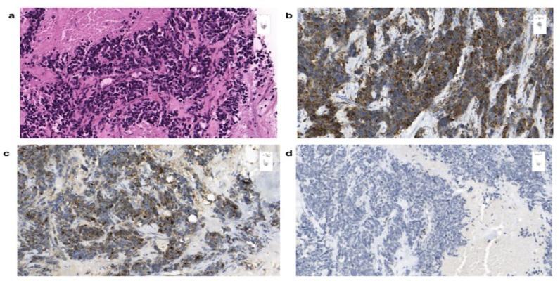 https://cdn.ncbi.nlm.nih.gov/pmc/blobs/f723/7140078/da1e850979ac/cancers-12-00733-g006.jpg