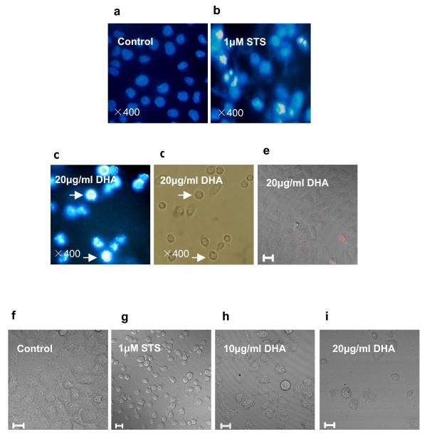 https://cdn.ncbi.nlm.nih.gov/pmc/blobs/f724/2653522/40b3ebe4c200/1423-0127-16-16-2.jpg