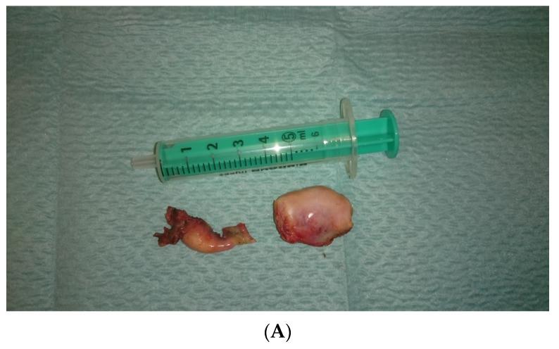 https://cdn.ncbi.nlm.nih.gov/pmc/blobs/f728/9916373/d98bafad8f07/ijerph-20-02139-g003a.jpg