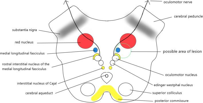 https://cdn.ncbi.nlm.nih.gov/pmc/blobs/f72b/7908666/4b05651e2628/12886_2021_1868_Fig3_HTML.jpg