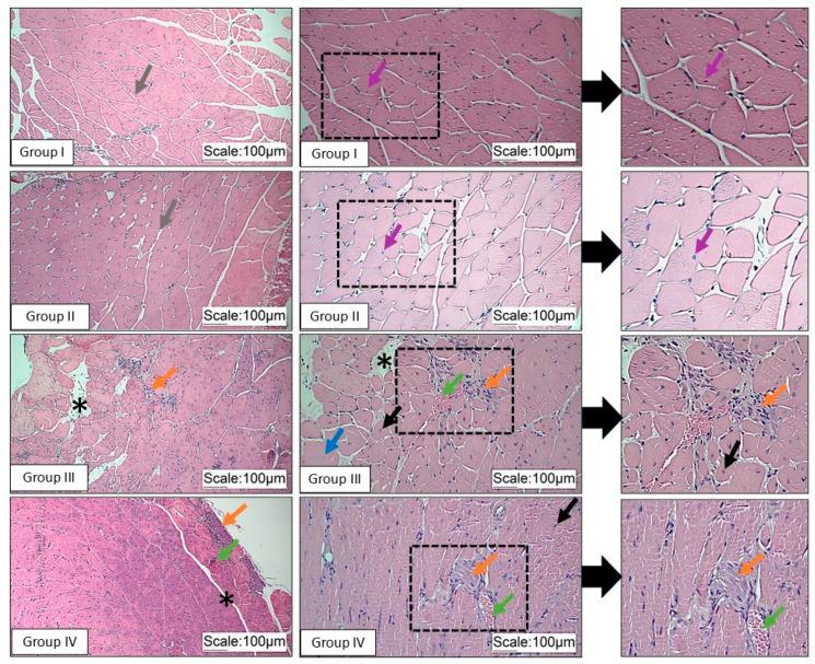 https://cdn.ncbi.nlm.nih.gov/pmc/blobs/f731/11755625/5ea8915acd6e/pathophysiology-32-00002-g002.jpg