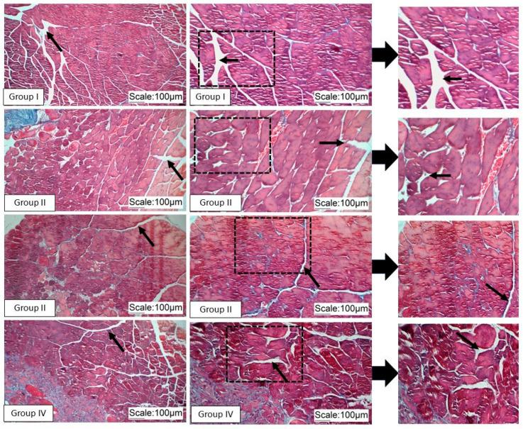 https://cdn.ncbi.nlm.nih.gov/pmc/blobs/f731/11755625/ce46a5238d65/pathophysiology-32-00002-g004.jpg