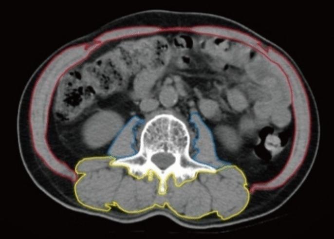 https://cdn.ncbi.nlm.nih.gov/pmc/blobs/f733/12167240/fd38f942eb33/384_2025_4932_Fig2_HTML.jpg