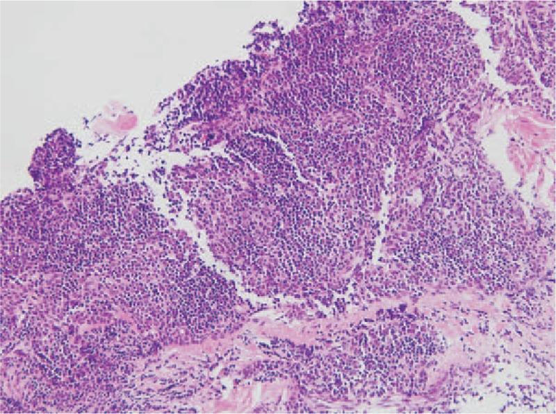 https://cdn.ncbi.nlm.nih.gov/pmc/blobs/f734/5228645/1e08ac21c262/medi-96-e5408-g003.jpg