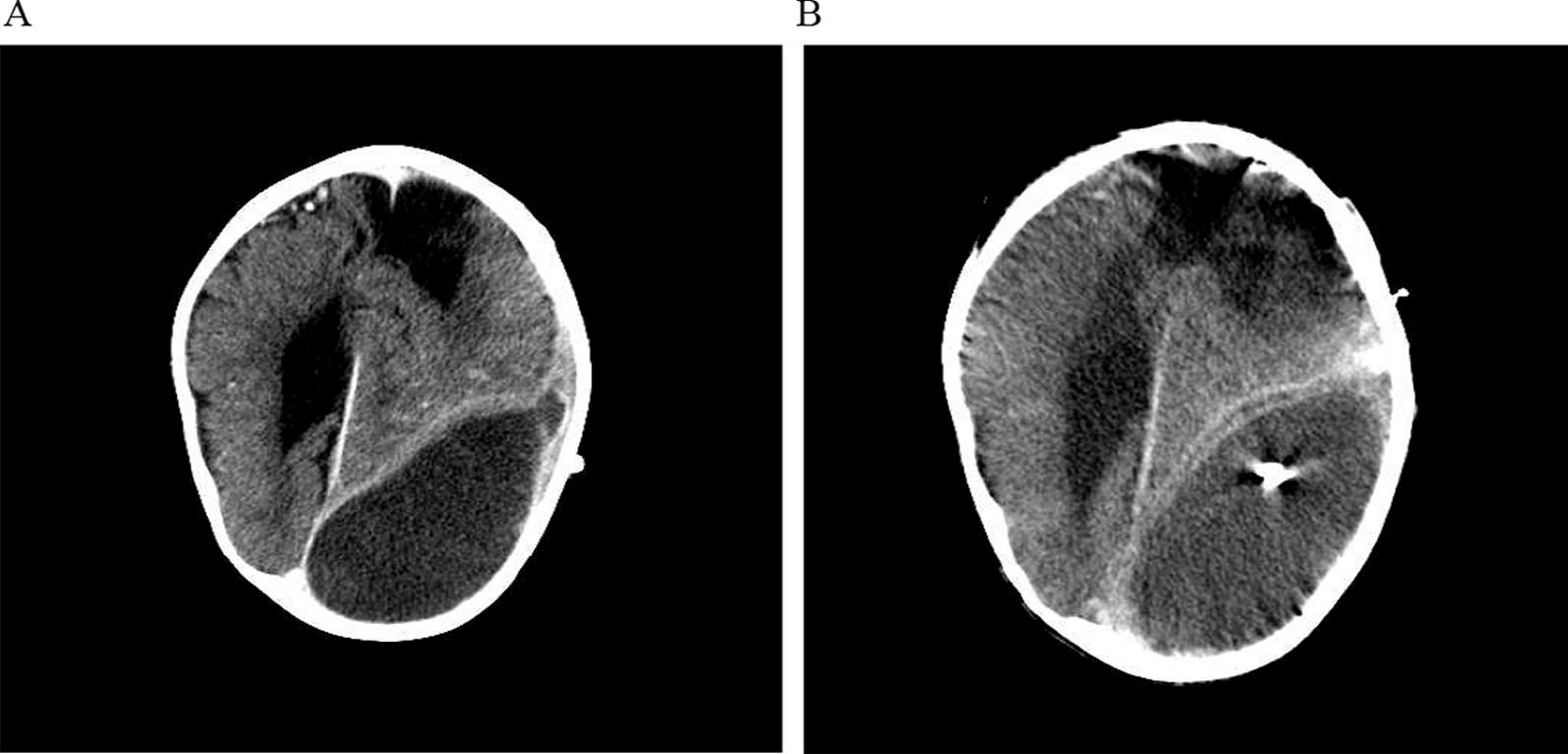 https://cdn.ncbi.nlm.nih.gov/pmc/blobs/f739/9392325/fc061b371716/12879_2022_7680_Fig1_HTML.jpg