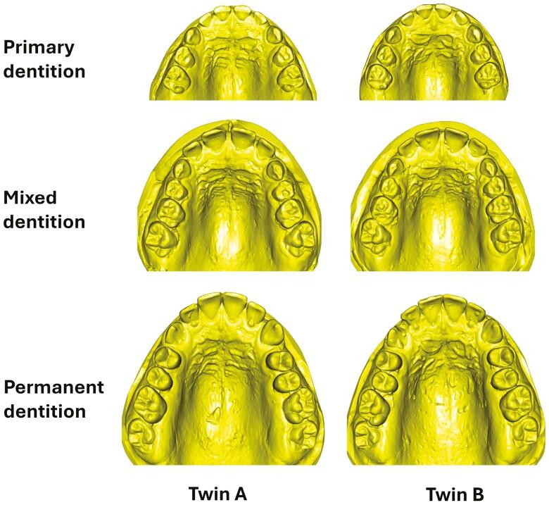 https://cdn.ncbi.nlm.nih.gov/pmc/blobs/f740/11659640/1496fff372a2/cjae076_fig1.jpg