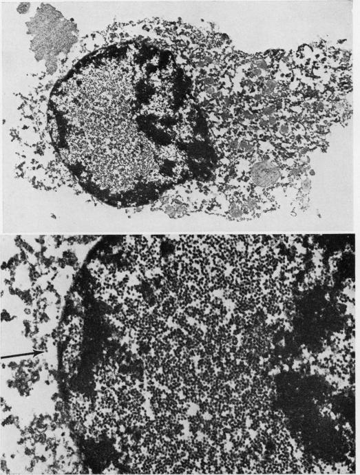 https://cdn.ncbi.nlm.nih.gov/pmc/blobs/f740/476627/85ba98913b89/jclinpath00169-0021-a.jpg