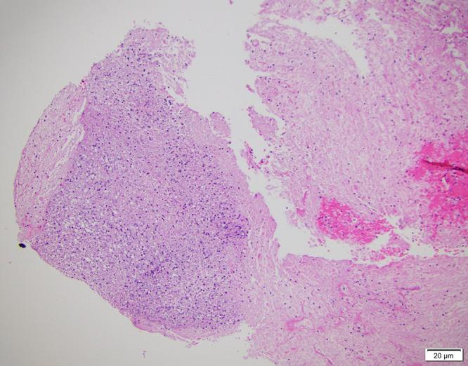 https://cdn.ncbi.nlm.nih.gov/pmc/blobs/f74f/10555547/600e9ddd0934/CASE22542f3.jpg