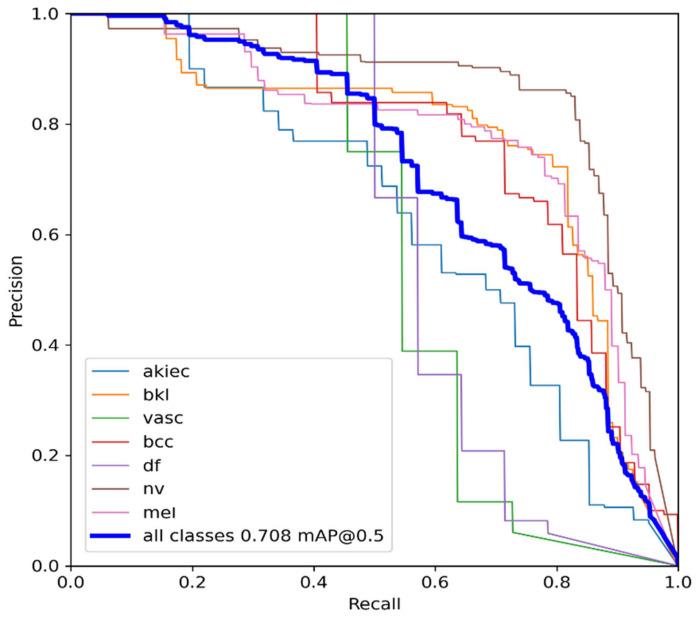 https://cdn.ncbi.nlm.nih.gov/pmc/blobs/f757/10486497/4607fd2ab1dc/diagnostics-13-02804-g006.jpg