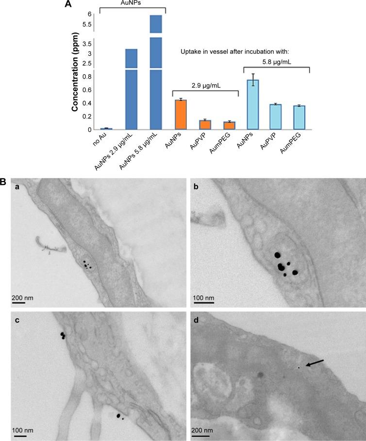 https://cdn.ncbi.nlm.nih.gov/pmc/blobs/f75f/5732551/1f1d98956b02/ijn-12-8813Fig8.jpg