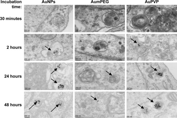 https://cdn.ncbi.nlm.nih.gov/pmc/blobs/f75f/5732551/d48fdf4e0e0d/ijn-12-8813Fig3.jpg
