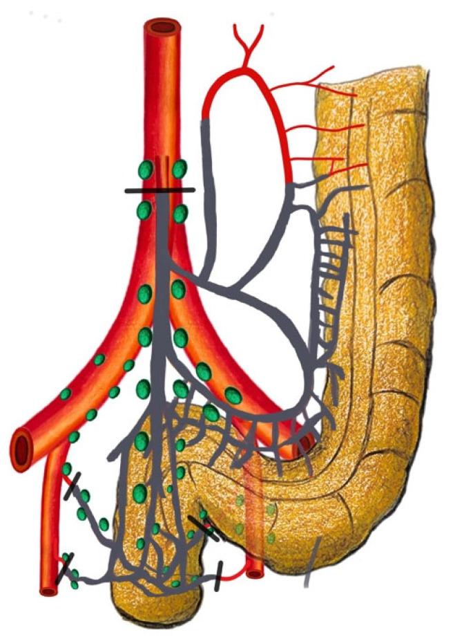 https://cdn.ncbi.nlm.nih.gov/pmc/blobs/f760/10777981/9a650f0452fb/cancers-16-00072-g002.jpg