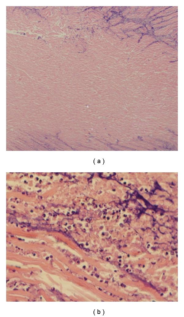 https://cdn.ncbi.nlm.nih.gov/pmc/blobs/f76d/3262519/adabc7c4e5c7/CARDIOLOGY2011-319453.002.jpg