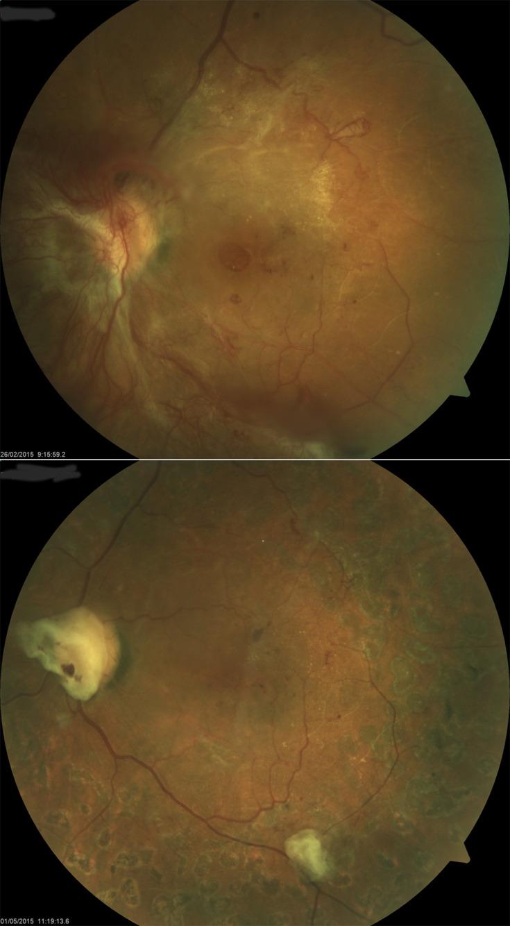 https://cdn.ncbi.nlm.nih.gov/pmc/blobs/f772/7718992/5c5636fde09f/OPTH-14-4125-g0001.jpg