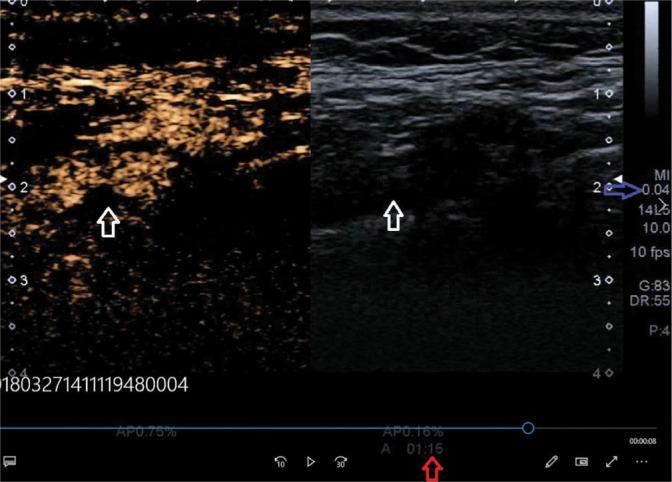 https://cdn.ncbi.nlm.nih.gov/pmc/blobs/f77a/7705485/e991ba4b33b6/jou-20-82-e191-g011.jpg