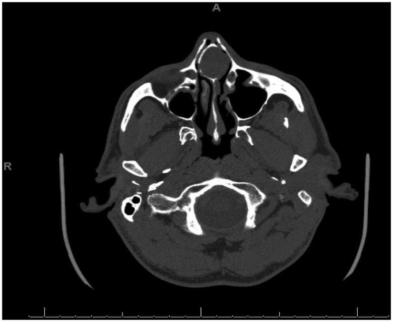 https://cdn.ncbi.nlm.nih.gov/pmc/blobs/f77e/6542106/452a8ca875e2/10.1177_2152656719845325-fig1.jpg