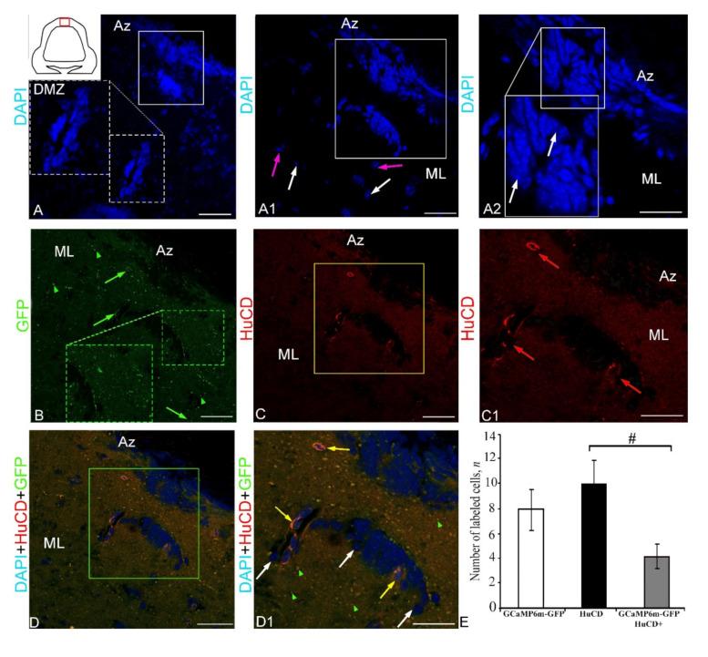 https://cdn.ncbi.nlm.nih.gov/pmc/blobs/f77e/9101580/0bb0afdf0a8d/ijms-23-04947-g001.jpg
