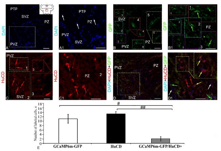 https://cdn.ncbi.nlm.nih.gov/pmc/blobs/f77e/9101580/a49796a56702/ijms-23-04947-g010.jpg