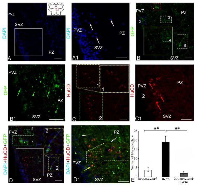 https://cdn.ncbi.nlm.nih.gov/pmc/blobs/f77e/9101580/a572ee945ab0/ijms-23-04947-g008.jpg