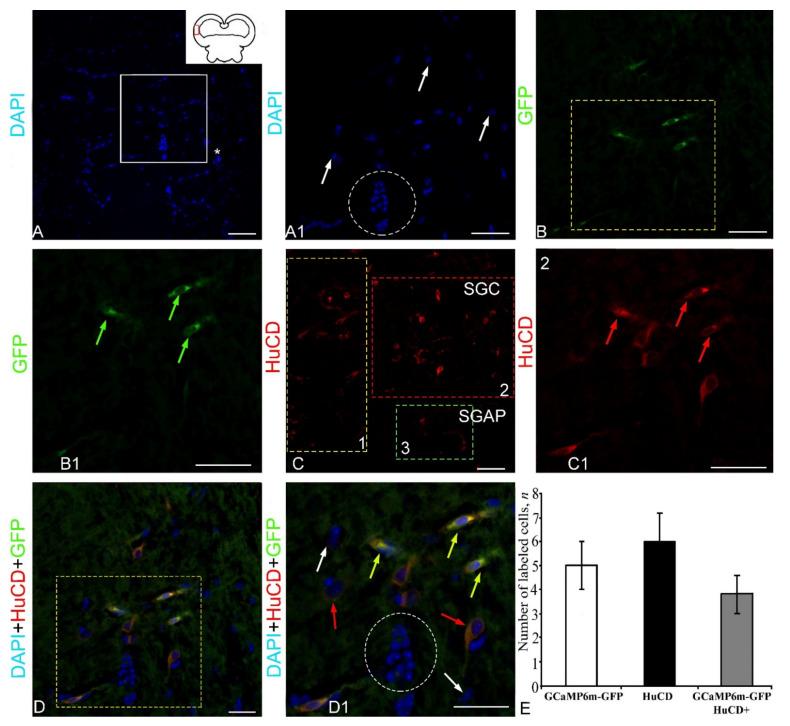 https://cdn.ncbi.nlm.nih.gov/pmc/blobs/f77e/9101580/eed66ed04993/ijms-23-04947-g006.jpg